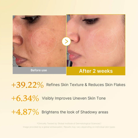 [Medicube] Kojic Acid Turmeric Toner, 250ml