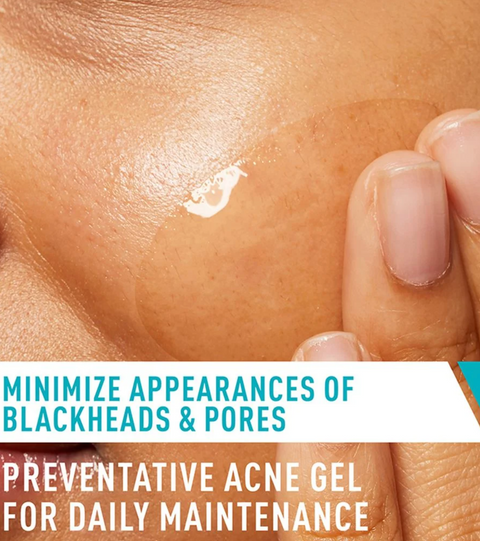 Acne Control Gel