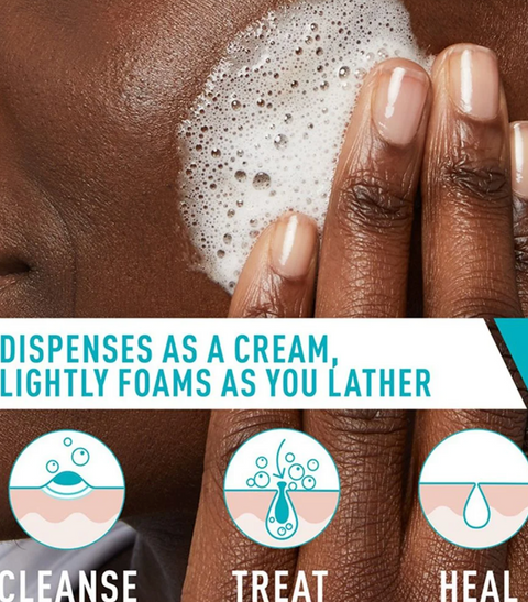 Acne Foaming Cream Cleanser
