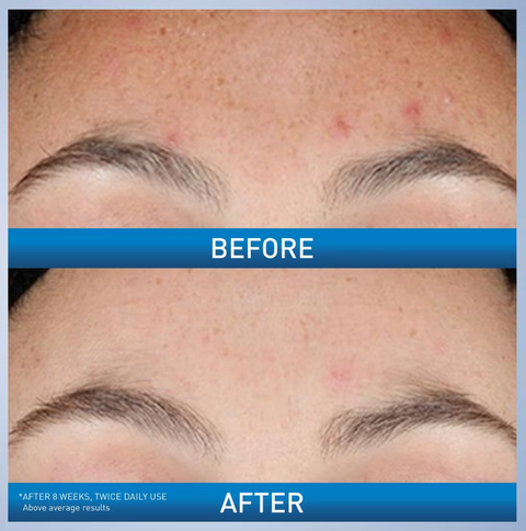 Resurfacing Retinol Serum