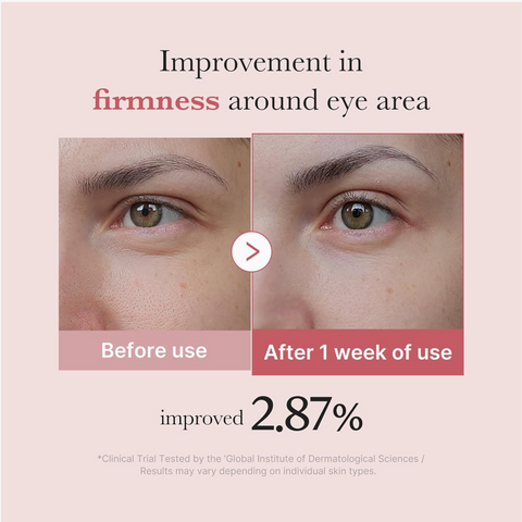 PDRN Pink Peptide Eye Cream 30ml