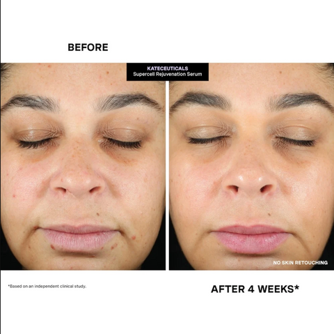 KateCeuticals SuperCell Rejuvenation Serum - 1oz / 30ml